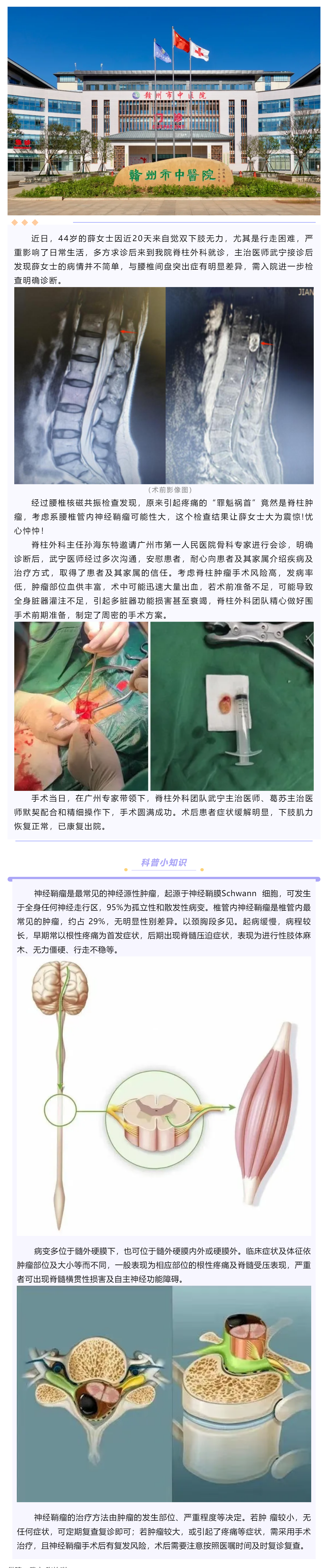 腰腿痛、下肢乏力麻木，提防神經(jīng)鞘瘤！.png